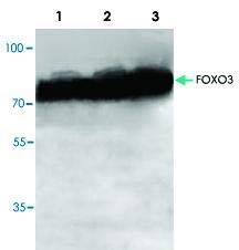 PAB8727-Boyut : 100 mikrogram - Anti-FOXO3 Tavşan Poliklonal Antikoru-Her Biri (100 mikrogram)