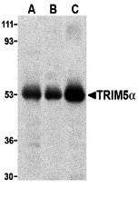 TRIM5 Alfa Antikoru